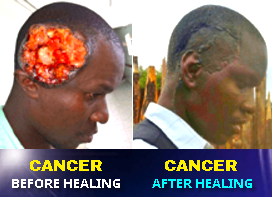 cancer-healed-nakuru-revival-prophet-owuor-2016